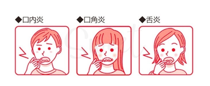 【日本】大正制药  口腔溃疡贴 口内炎贴纸 缓解口腔发炎不适 黄色加强版 贴纸/药膏两款/ TAISHO Oral Patch/Cream -  - 4@ - Sweet Living