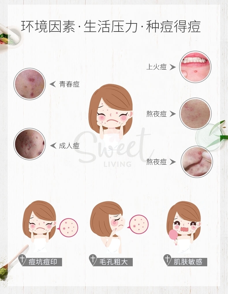 【日本】Lion 狮王祛痘膏 粉刺暗疮青春痘 去痘膏/ PAIR Acne Treatment Cream - @ - 4 - Sweet Living