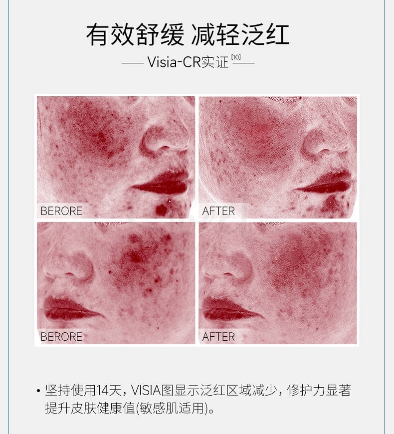 【中国】医药品牌 巨子生物 可复美 胶原棒 重组胶原蛋白肌御修复次抛精华 保湿修复 5支/30支/盒 / Comfy Collagen-Hyaluronic Repair Serum -  - 9@ - Sweet Living