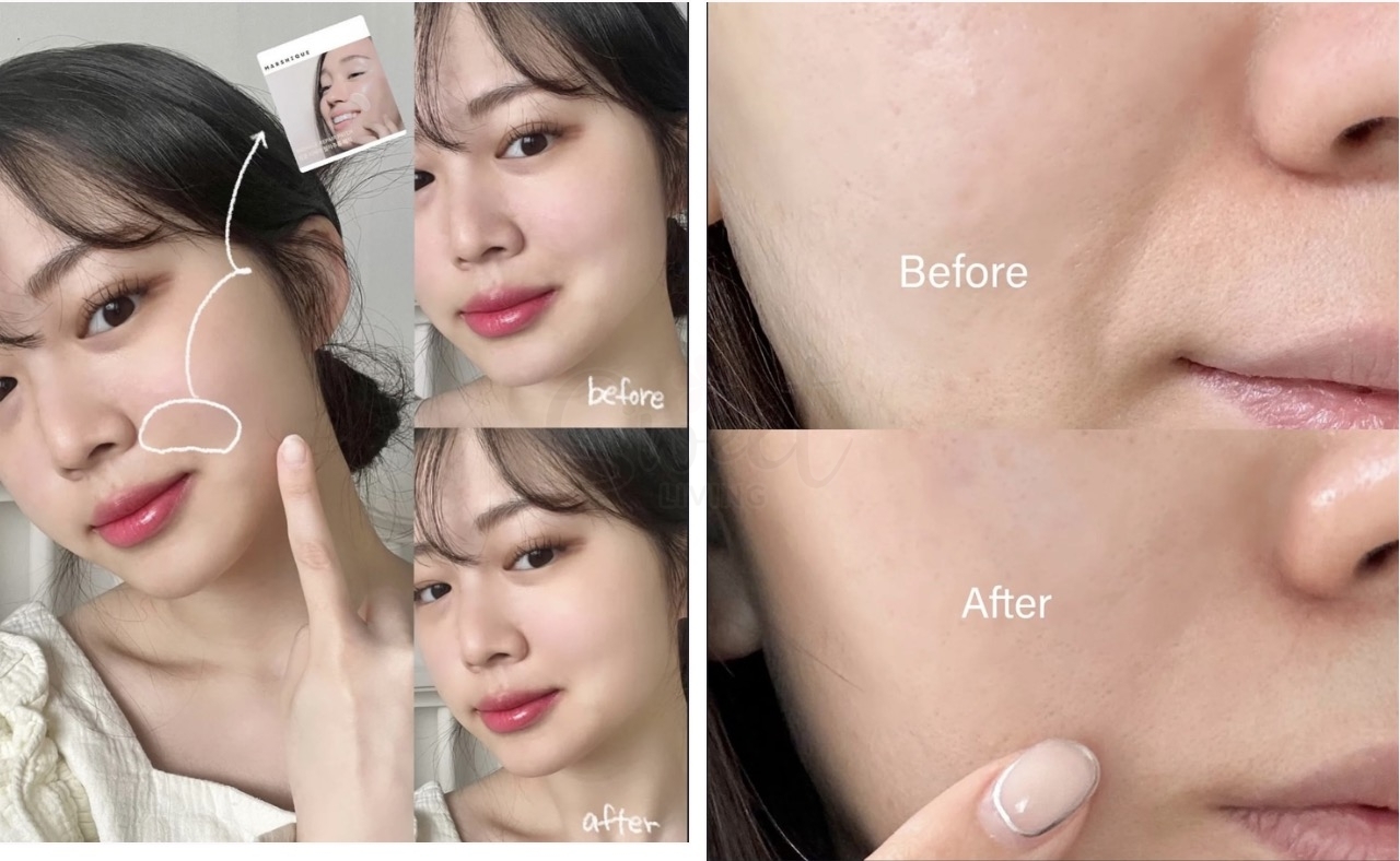 【韩国】Marshique 八字纹 川字纹 法令贴 改善皱纹细纹弹力紧致服帖 面膜 36枚 -  - 4@ - Sweet Living